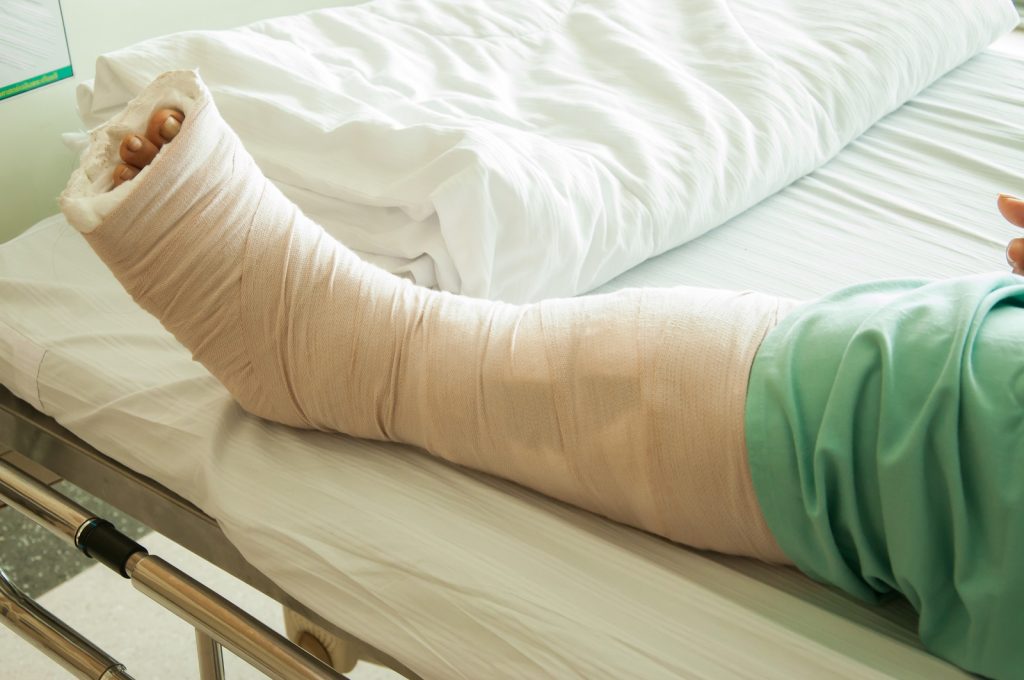 Leg Injury Compensation Claim