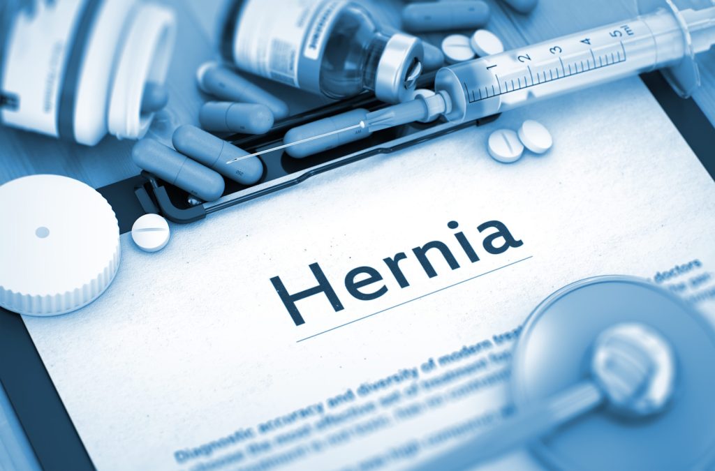 Hernia Compensation Claim