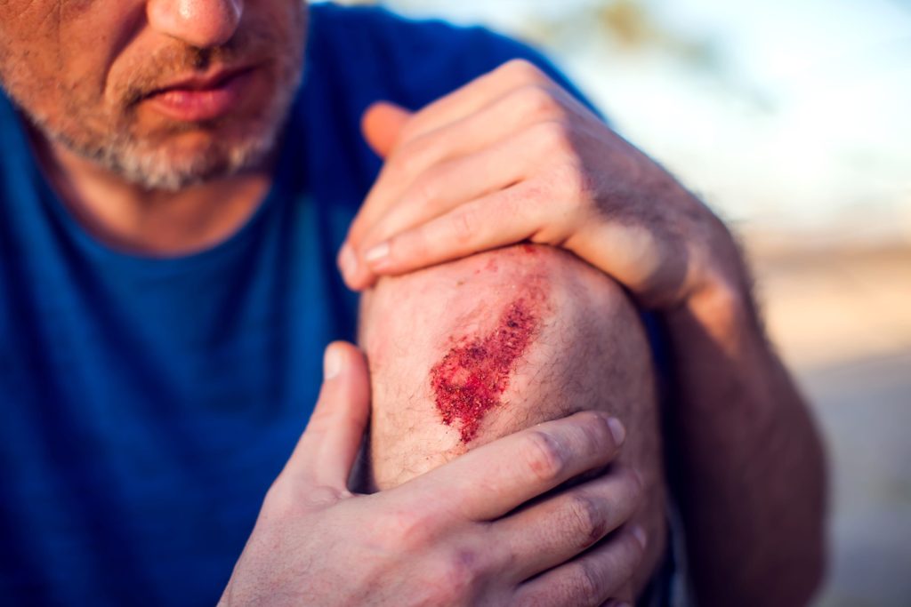 Abrasion Injury