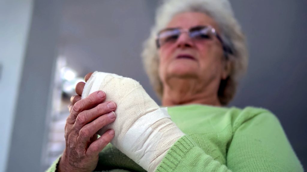 Scaphoid Fracture