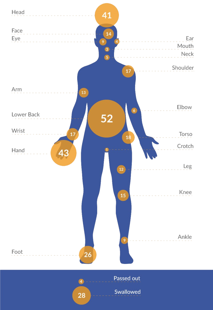 Injuries To The Body