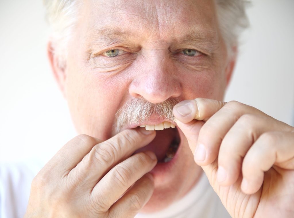 Damaged Teeth