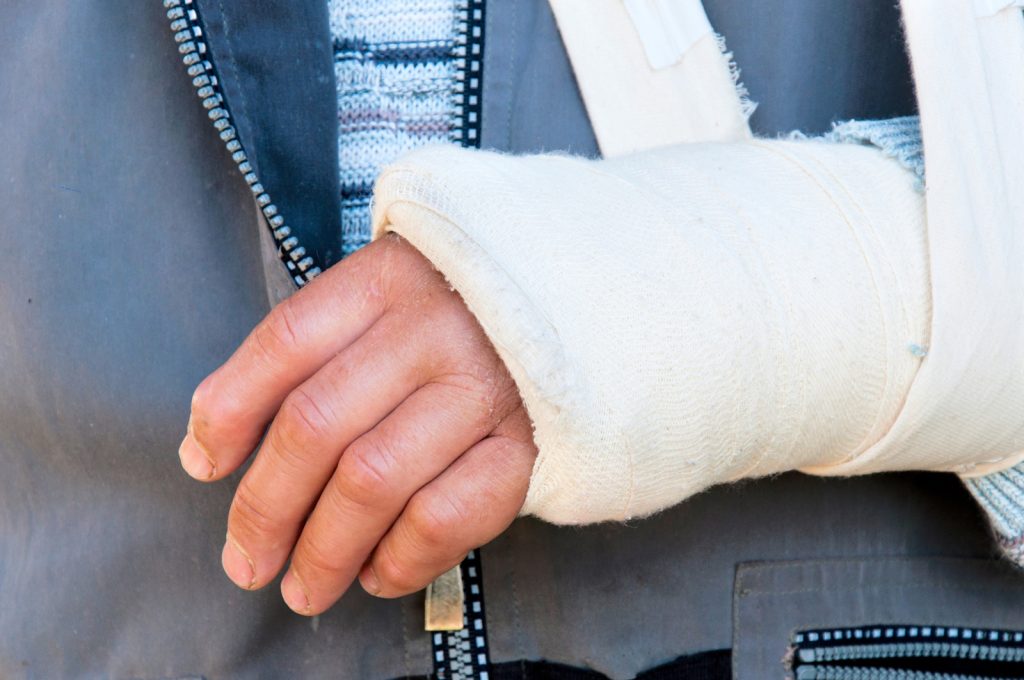 Arm Injury Compensation Claim