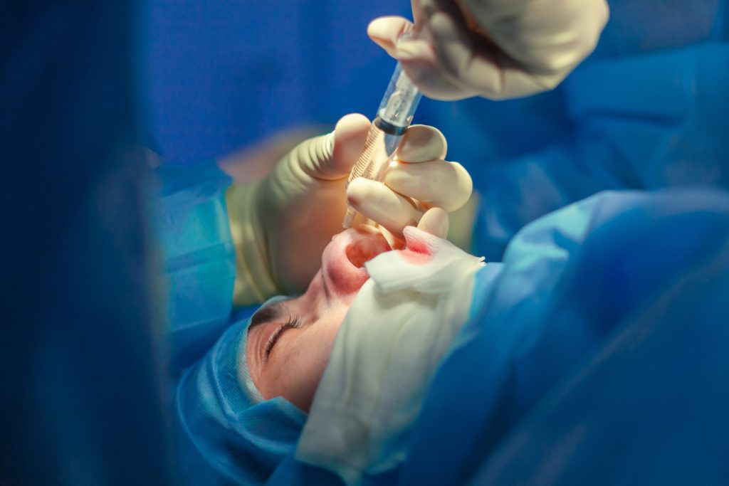 Rhinoplasty Compensation Claim