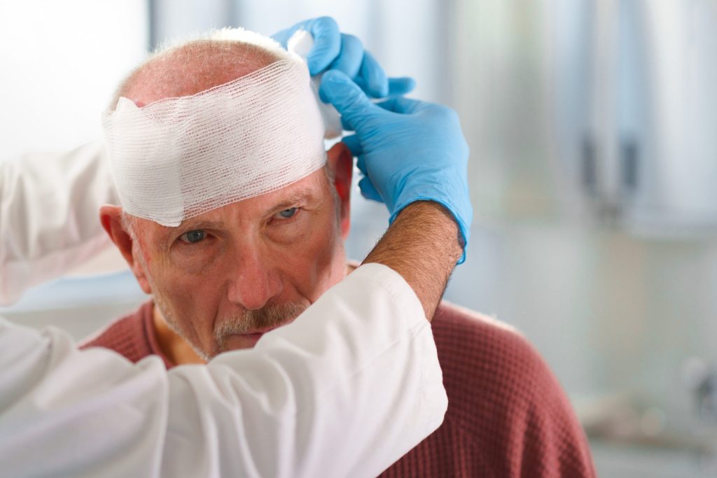 Head Injury Claim