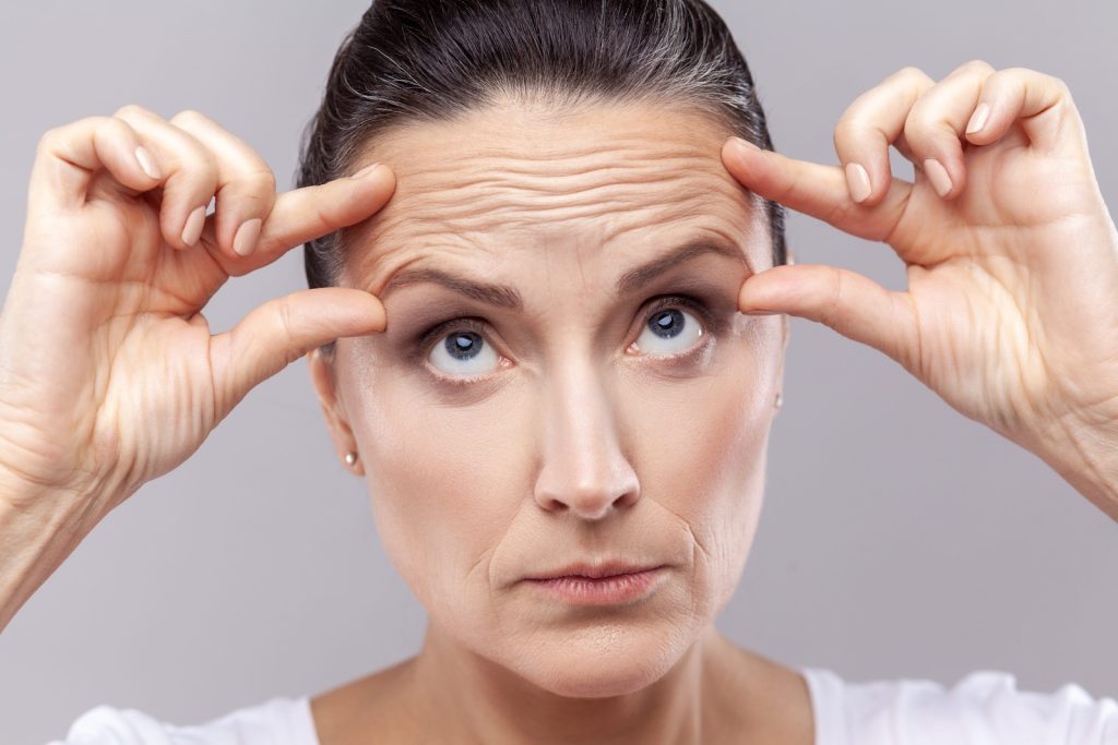 Brow Lift