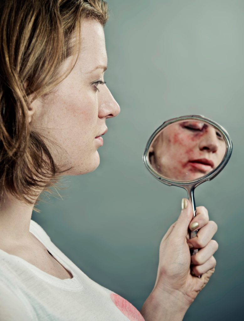 Facial Scar Compensation Claim