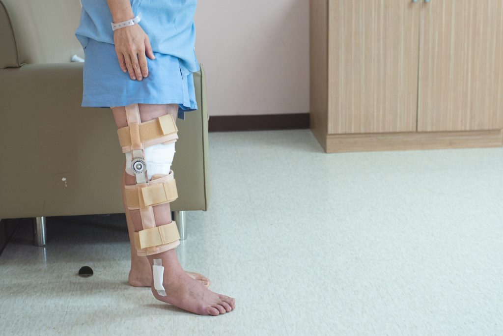 Ligament Injury Claim