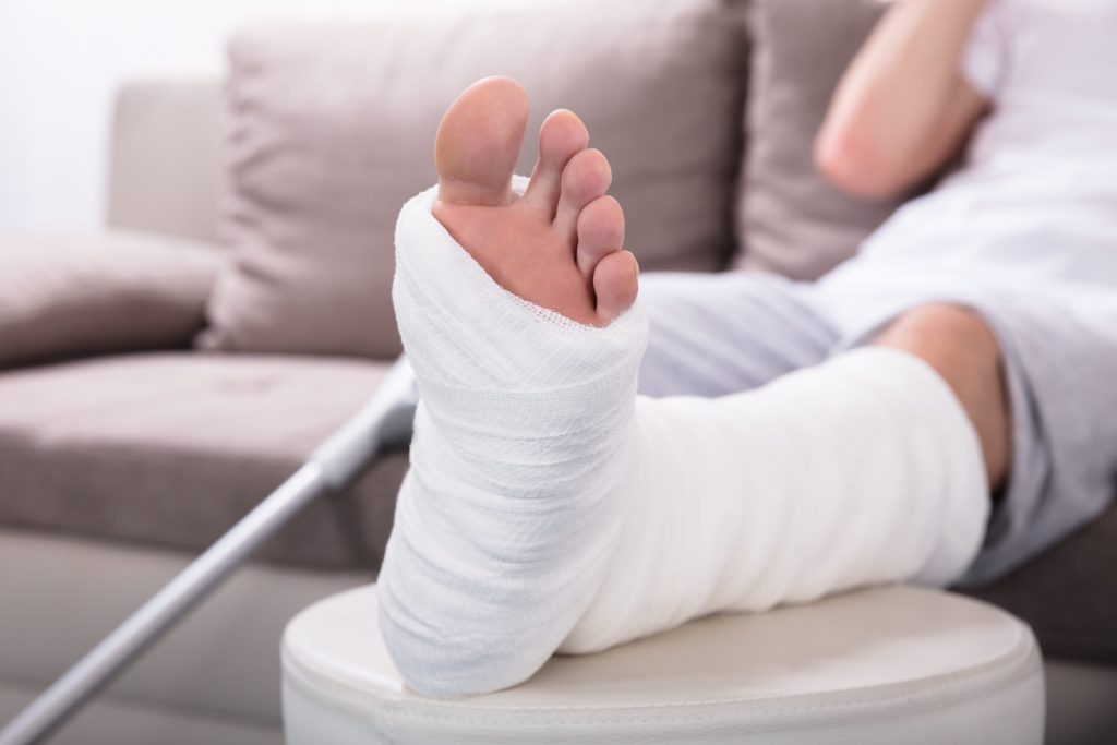 Misdiagnosed Fracture Claim
