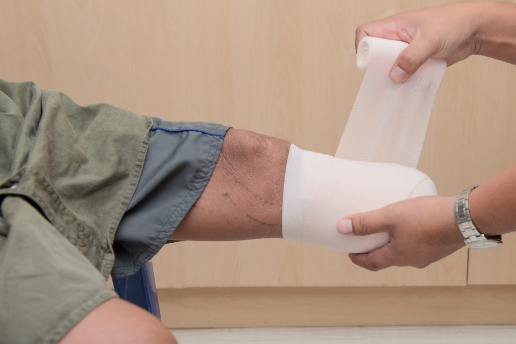 Leg Amputation