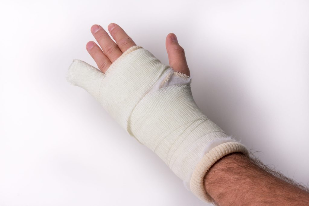 Broken Wrist
