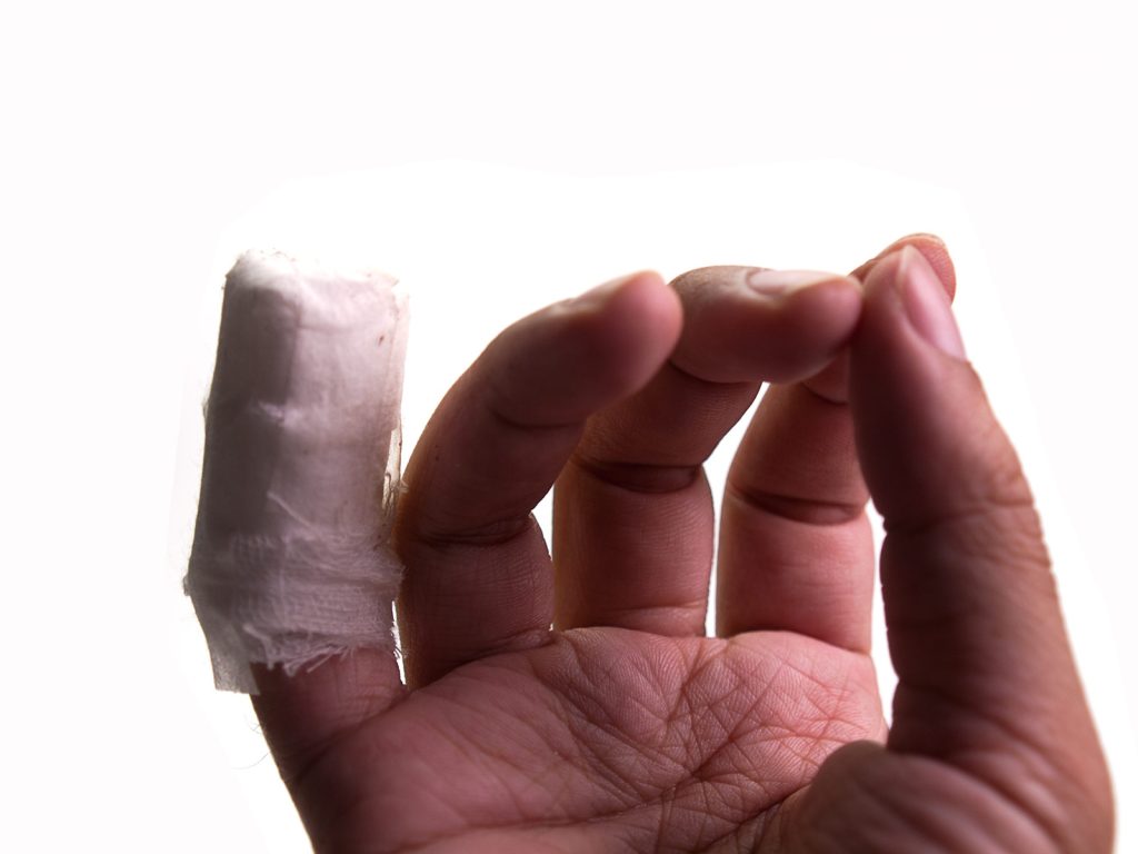 Broken Finger At Work