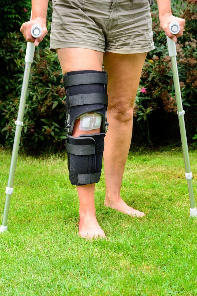 Fractured Patella Claim