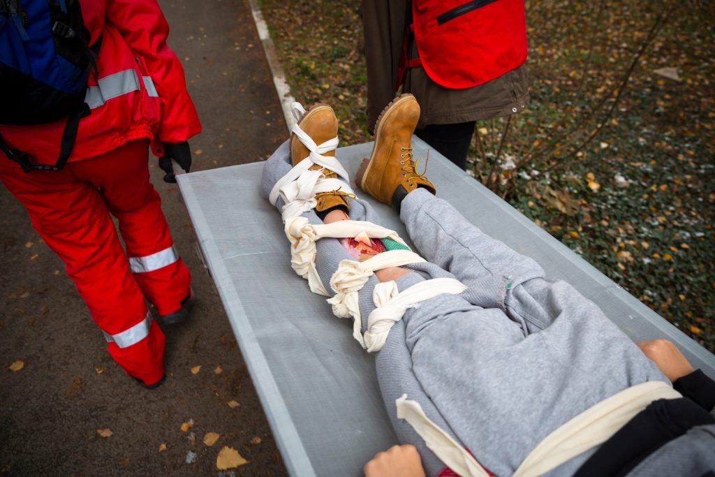 Broken Femur