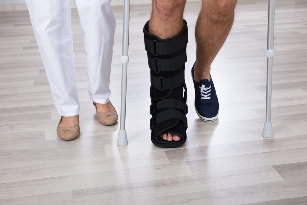 Broken Tibia And Fibula