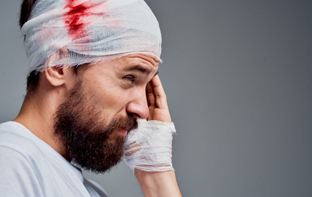 Fractured Skull