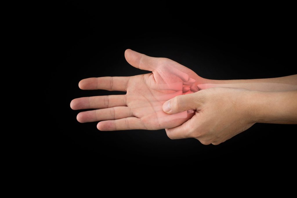 Fractured Metacarpal