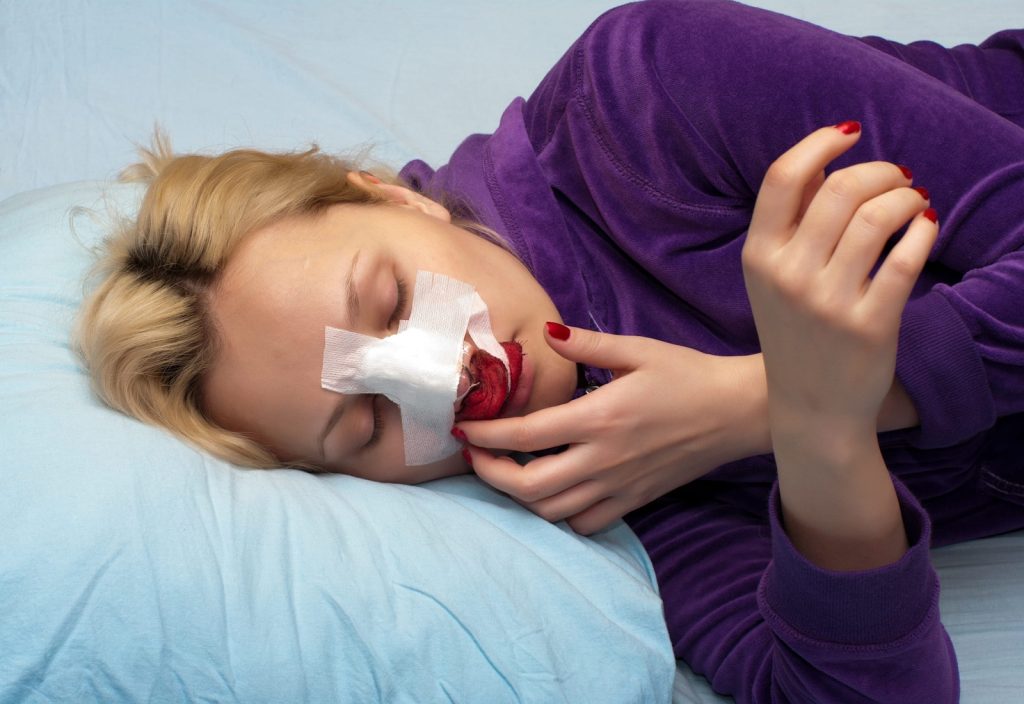 Facial Disfigurement Injury